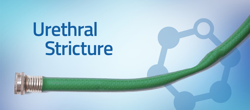 urethral stricture AUS